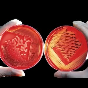 Anti-infectives-430-px-300x300